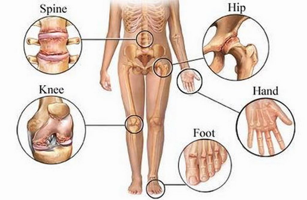 TYPES OF JOINTS
